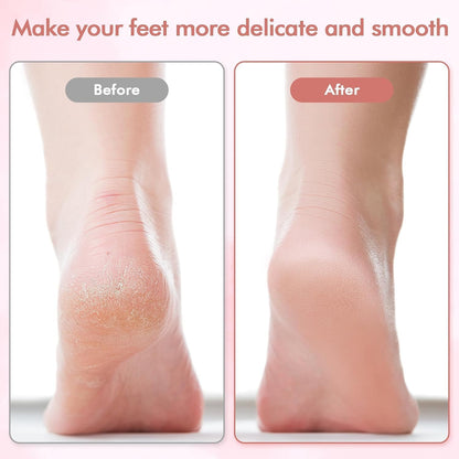 Feet Callus Remover